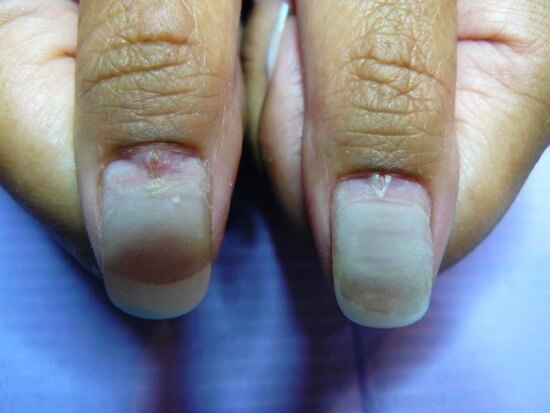 Last van 5 tips om je nagels te (laten) herstellen - Nagelstudio Floranails Cuijk